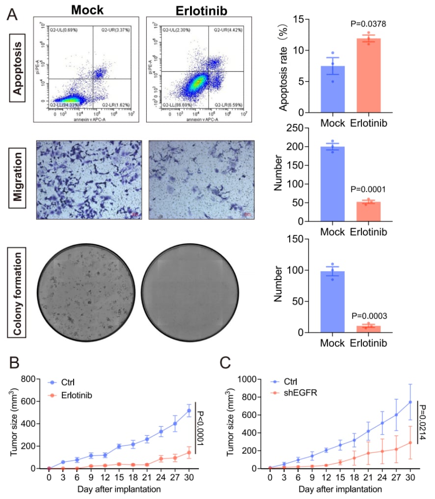 肾透明细胞癌治疗新方向:强化学习识别EGFR等关键风险基因 6 抑制EGFR表达在体内外实验中抑制ccRCC进展