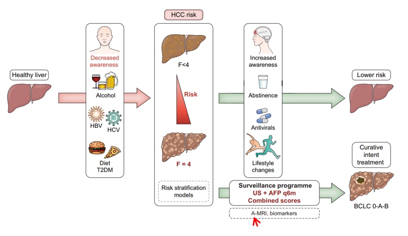 深度解读EASL 2024肝癌指南:最新治疗策略与争议点分析 2 预防HCC相关过早死亡的机会