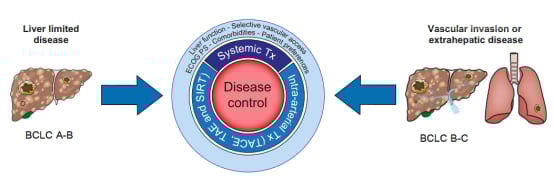 深度解读EASL 2024肝癌指南:最新治疗策略与争议点分析 8 以控制疾病为目的的治疗方法