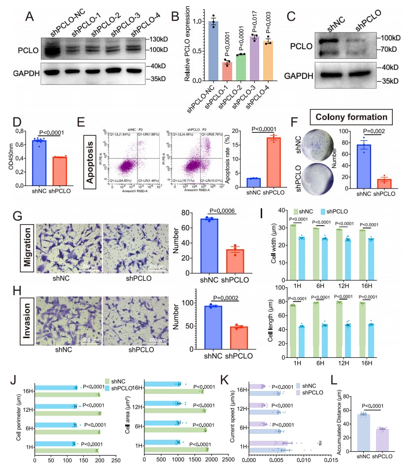 肾透明细胞癌治疗新方向:强化学习识别EGFR等关键风险基因 7 PCLO失调显著影响ccRCC的进展