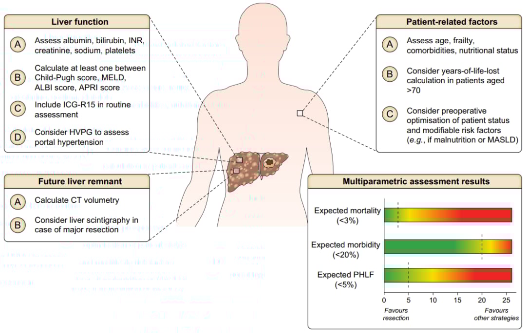 深度解读EASL 2024肝癌指南:最新治疗策略与争议点分析 7 适合肝切除术患者的多参数术前评估
