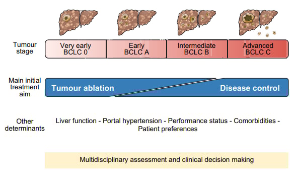 深度解读EASL 2024肝癌指南:最新治疗策略与争议点分析 4 MDT模式