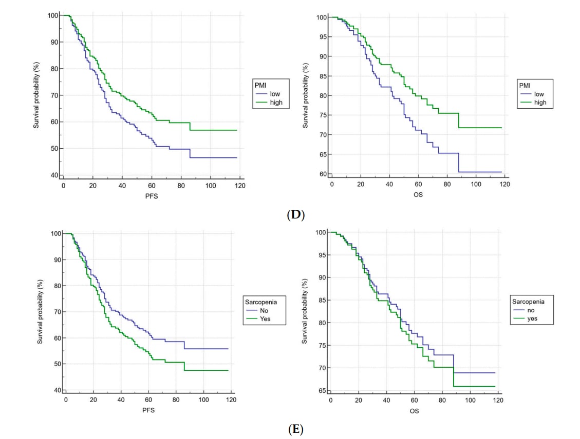 新发现:CT扫描揭示局部晚期直肠癌生存密码,脂肪指数成关键预后指标 2 1761057635100_92910.png