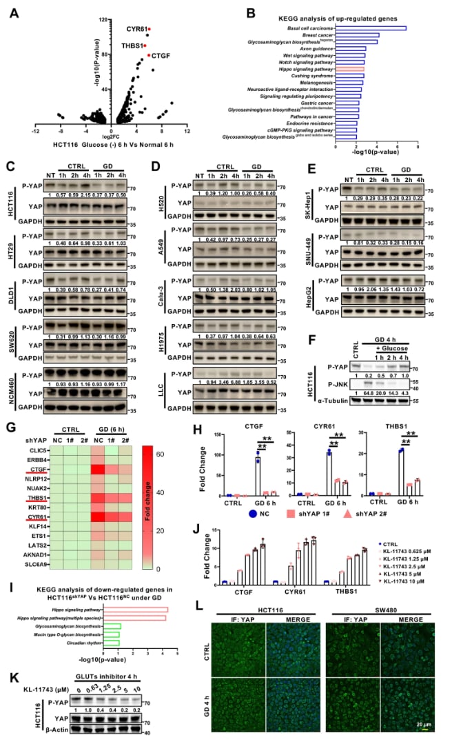 癌症代谢治疗新突破:D-核糖-5-磷酸如何“关闭”促癌蛋白YAP? 2 1751876712971_8106296.png