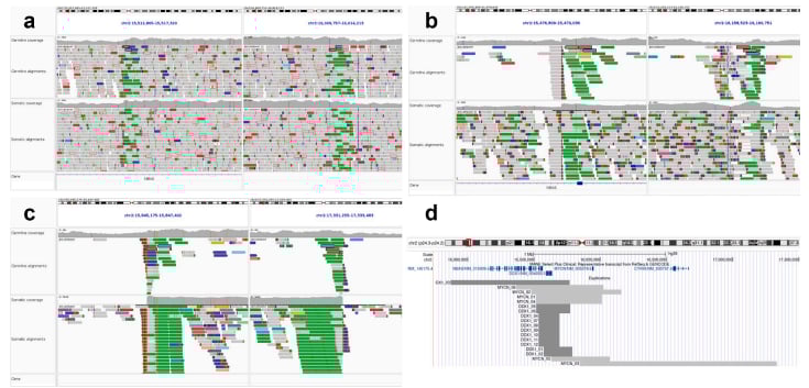 MYCN基因微重复:解密儿童神经母细胞瘤与肾母细胞瘤的遗传密码,家族筛查与早防早治新希望 3 1770083280572_92910.png