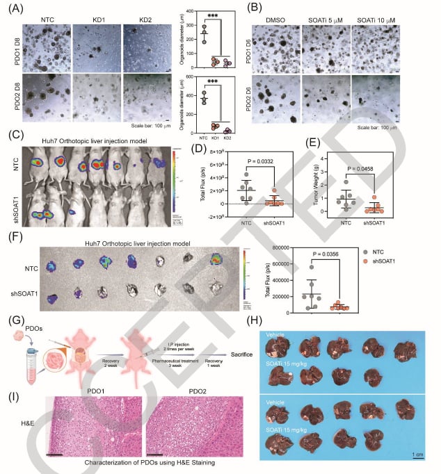 肝癌治疗新突破:靶向SOAT1联合PD-1抑制剂,实现代谢与免疫双重打击 3 1761114630845_9363901.png