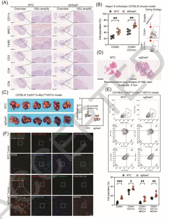 肝癌治疗新突破:靶向SOAT1联合PD-1抑制剂,实现代谢与免疫双重打击 4 1761114630861_9363901.png