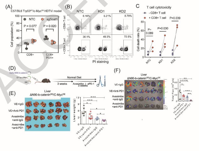 肝癌治疗新突破:靶向SOAT1联合PD-1抑制剂,实现代谢与免疫双重打击 5 1761114630867_9363901.png