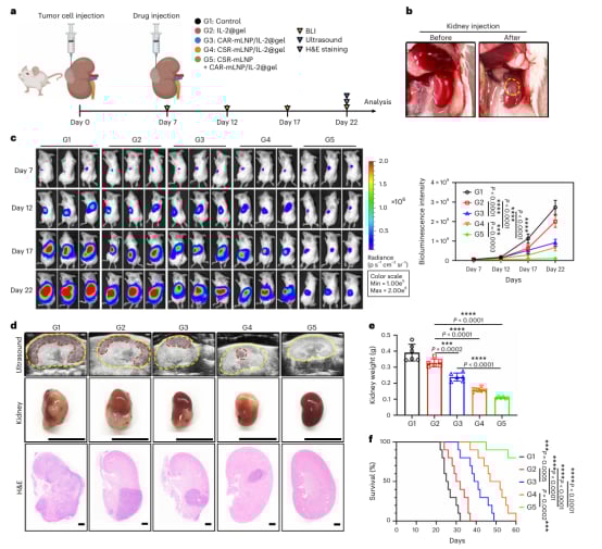肾细胞癌治疗新希望:CAR巨噬细胞疗法如何精准抗癌并重塑肿瘤微环境? 5 图片