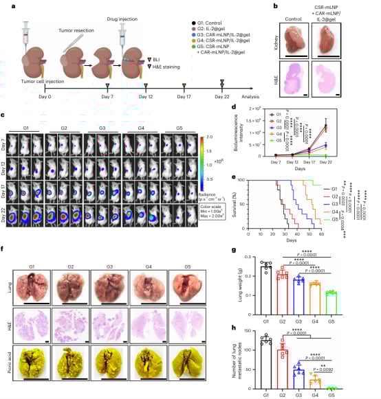肾细胞癌治疗新希望:CAR巨噬细胞疗法如何精准抗癌并重塑肿瘤微环境? 7 图片