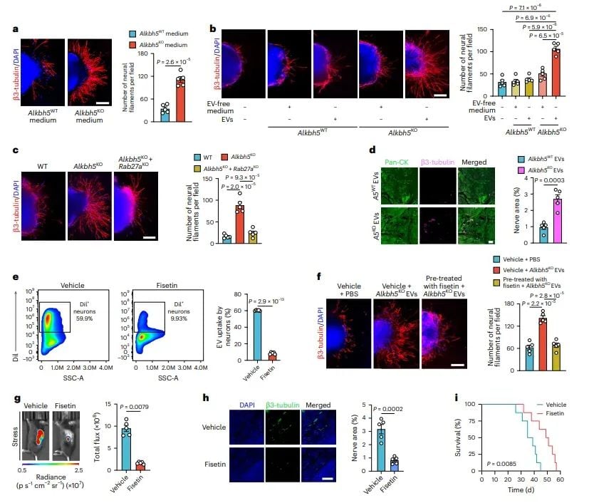 警惕!心理压力竟是胰腺癌进展的隐形推手,新研究揭示治疗新靶点 5 图片