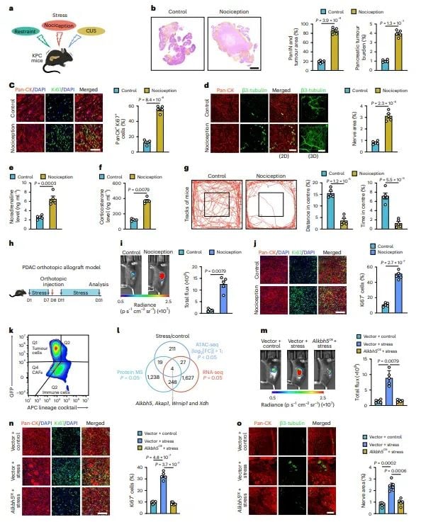警惕!心理压力竟是胰腺癌进展的隐形推手,新研究揭示治疗新靶点 2 图片