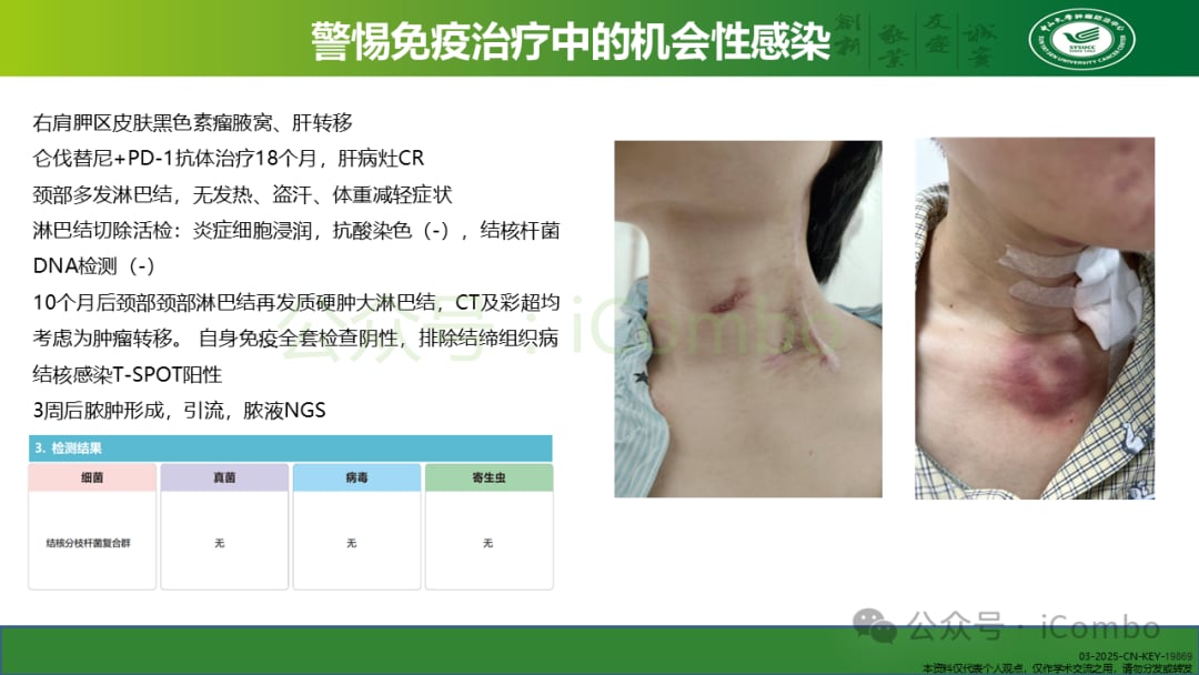 癌症免疫治疗不良反应管理:平衡疗效与安全的关键策略 19 图片