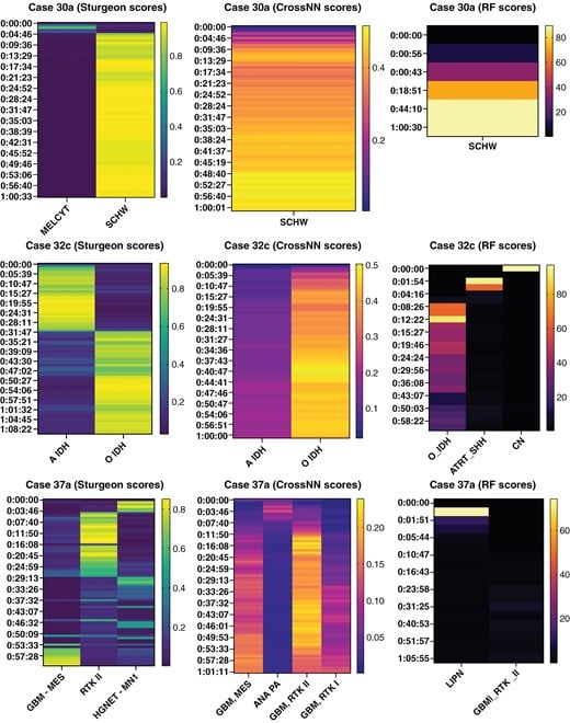 革新脑肿瘤诊断:ROBIN纳米孔技术实现2小时快速分类与24小时全面分子图谱 3 图片