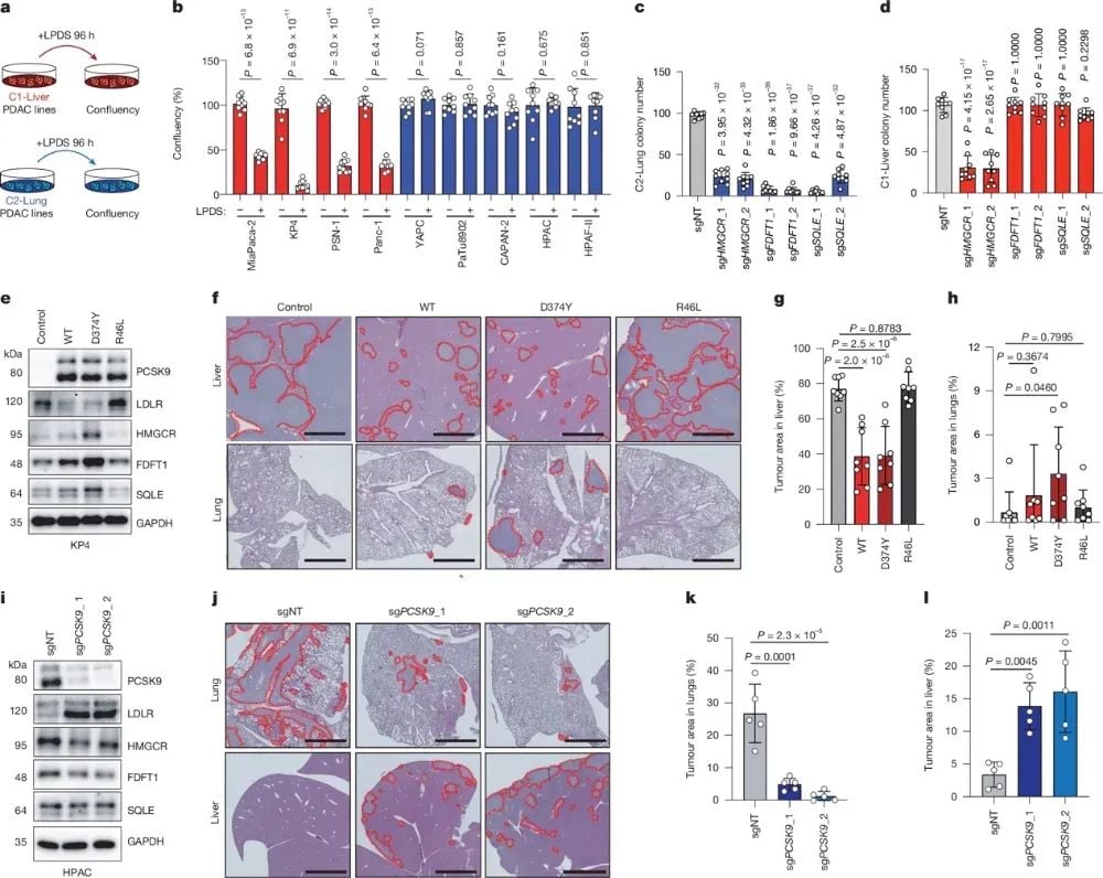 胰腺癌转移新突破:PCSK9如何决定肿瘤“落脚点”? 4 图片