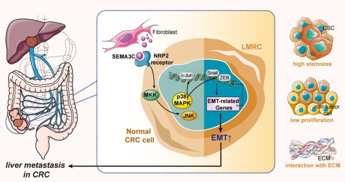 结直肠癌肝转移新突破:SEMA3C-NRP2轴揭示潜在靶向治疗策略 2 图片