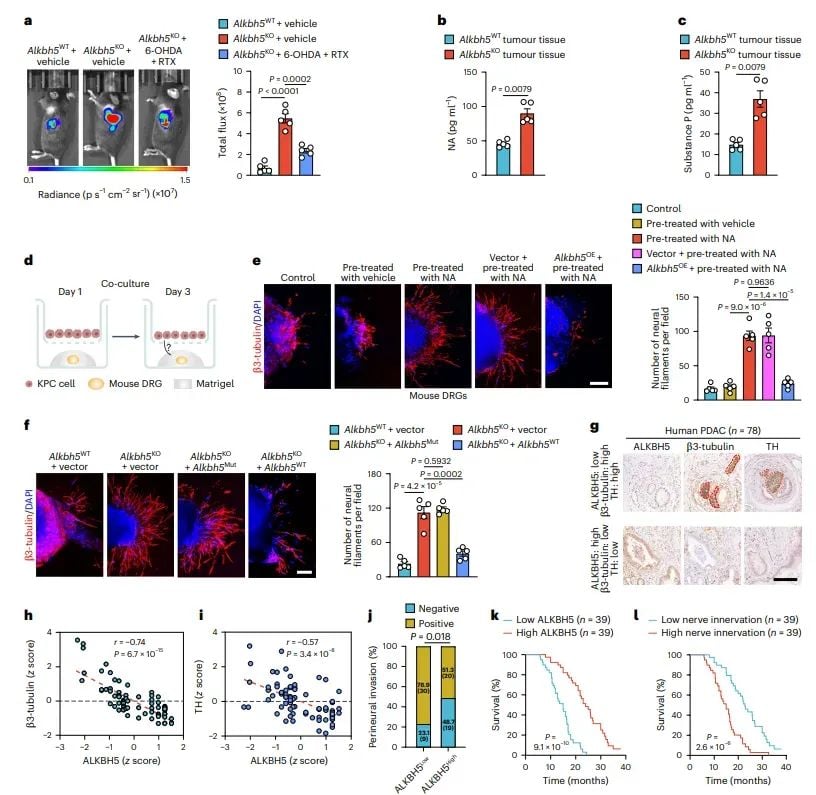 警惕!心理压力竟是胰腺癌进展的隐形推手,新研究揭示治疗新靶点 4 图片