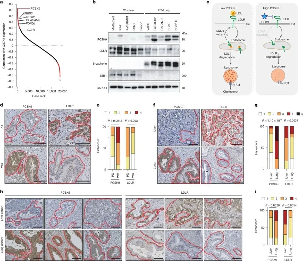 胰腺癌转移新突破:PCSK9如何决定肿瘤“落脚点”? 3 图片