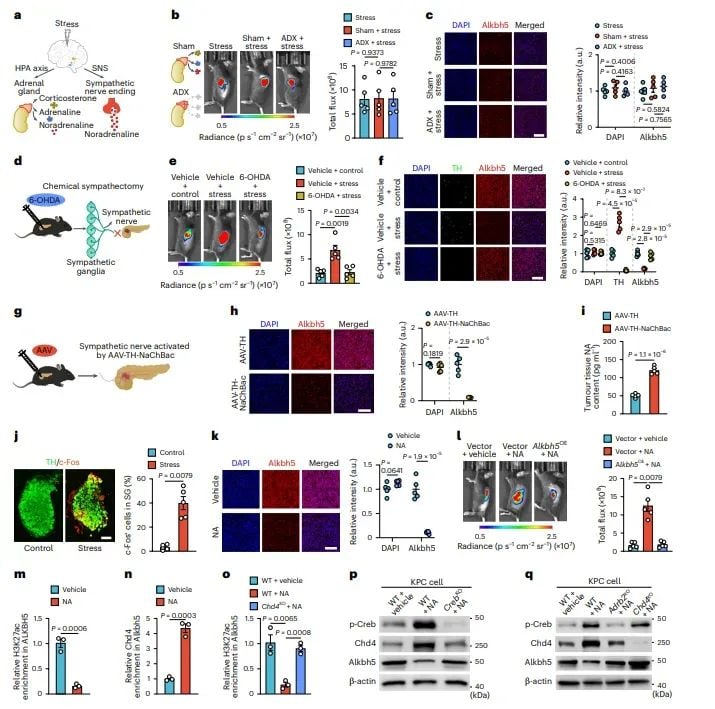 警惕!心理压力竟是胰腺癌进展的隐形推手,新研究揭示治疗新靶点 3 图片