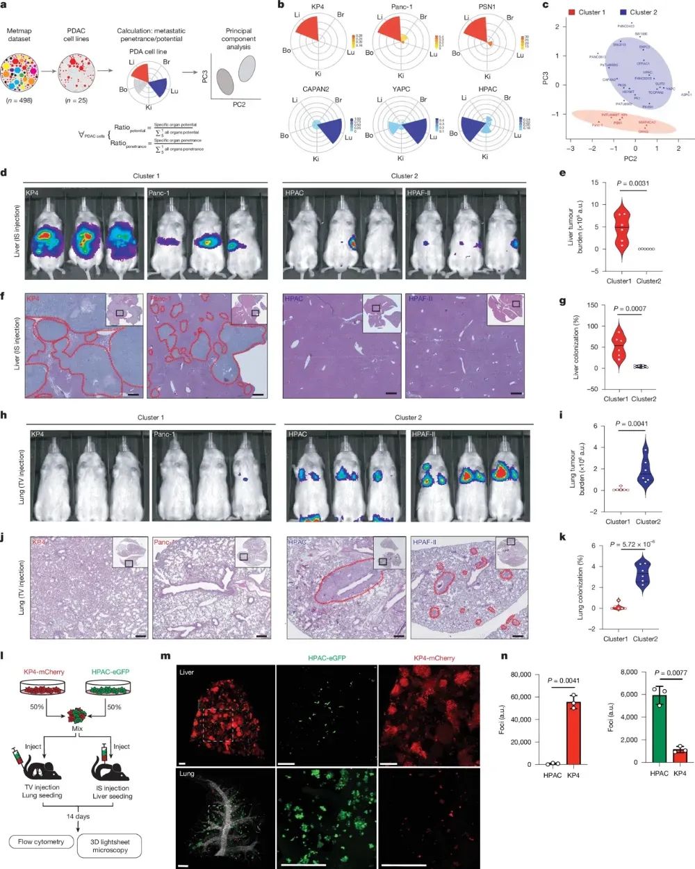 胰腺癌转移新突破:PCSK9如何决定肿瘤“落脚点”? 2 图片