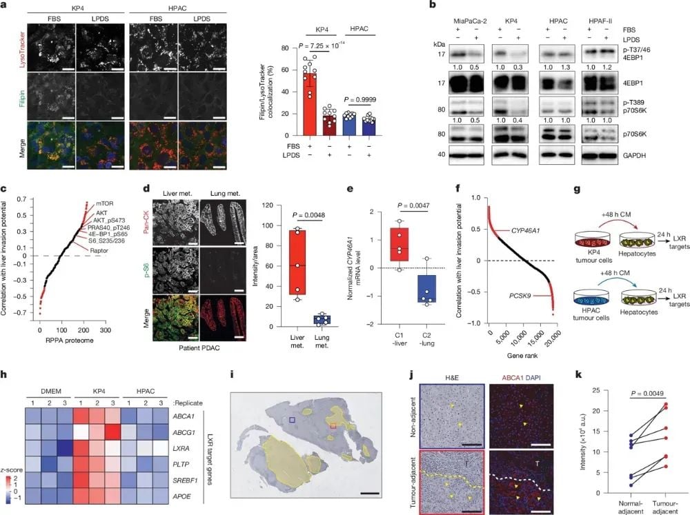胰腺癌转移新突破:PCSK9如何决定肿瘤“落脚点”? 5 图片