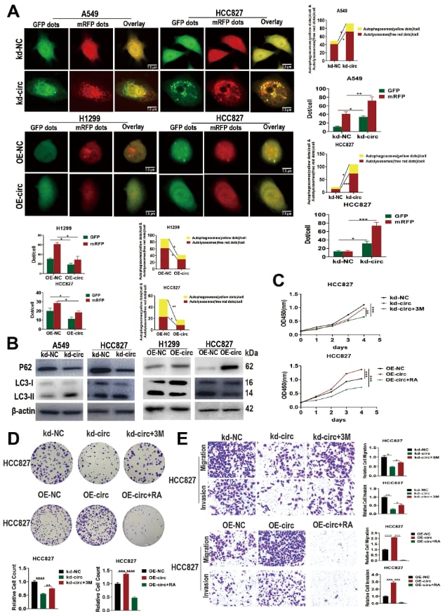 解码肺腺癌转移新机制:circRAPGEF5成为潜在治疗靶点 2 图片