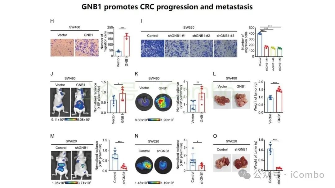 结直肠癌肝转移新突破:GNB1基因或成免疫治疗关键靶点 11 图片