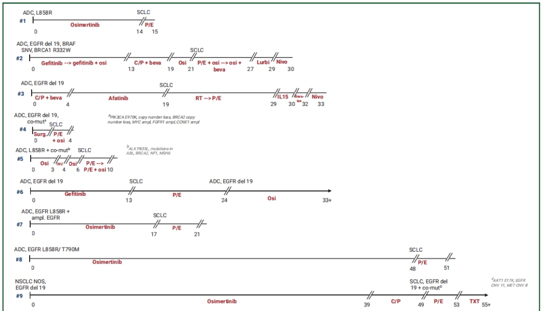 肺癌EGFR靶向药耐药后转化为小细胞肺癌:最新治疗方案与预后分析 5 图片