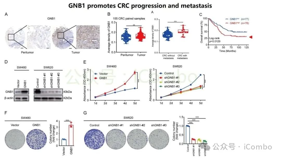结直肠癌肝转移新突破:GNB1基因或成免疫治疗关键靶点 10 图片