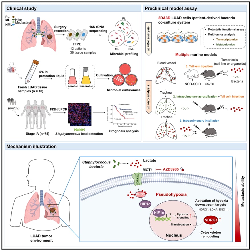 肺腺癌转移新发现:肿瘤内细菌竟是“帮凶”?MCT1成潜在治疗靶点 2 图片
