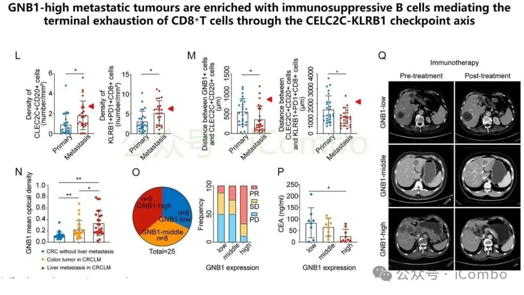 结直肠癌肝转移新突破:GNB1基因或成免疫治疗关键靶点 16 图片