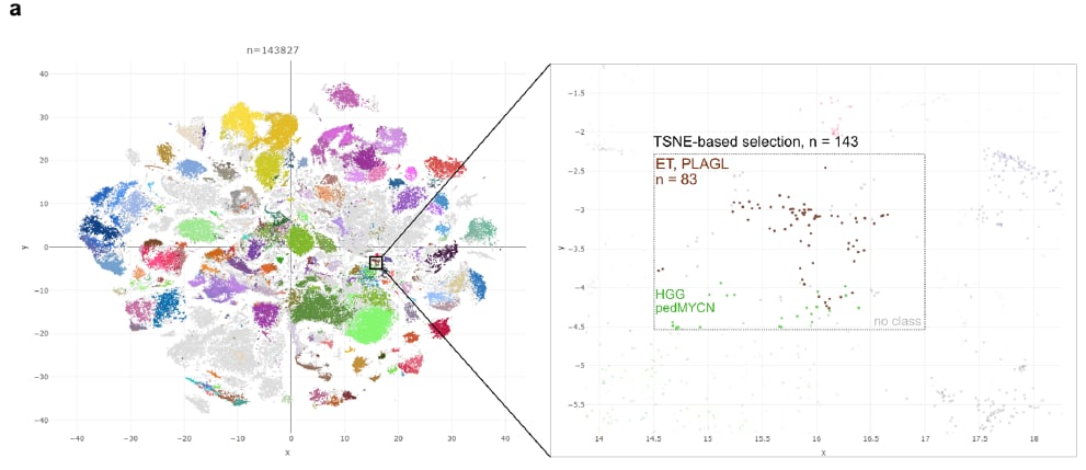 PLAG1融合:中枢神经系统胚胎性肿瘤分子分型新突破,揭示潜在靶点 2 图片