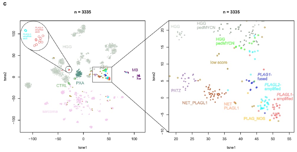 PLAG1融合:中枢神经系统胚胎性肿瘤分子分型新突破,揭示潜在靶点 4 图片