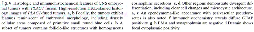 PLAG1融合:中枢神经系统胚胎性肿瘤分子分型新突破,揭示潜在靶点 10 图片
