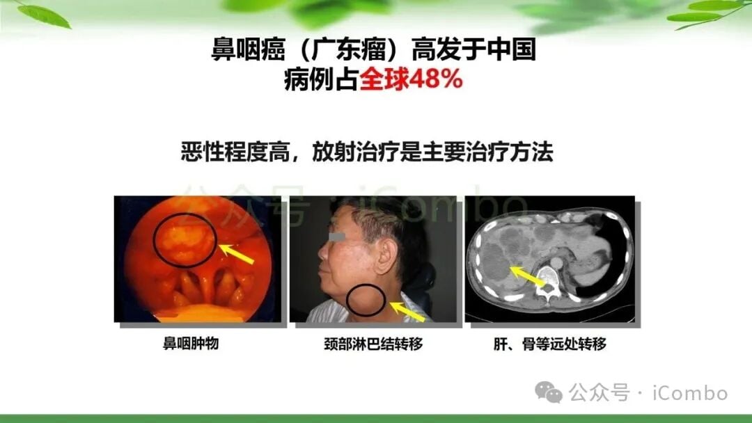 鼻咽癌治疗新篇章:PD-1单抗联合放疗,如何优化策略提升患者生存率? 2 图片