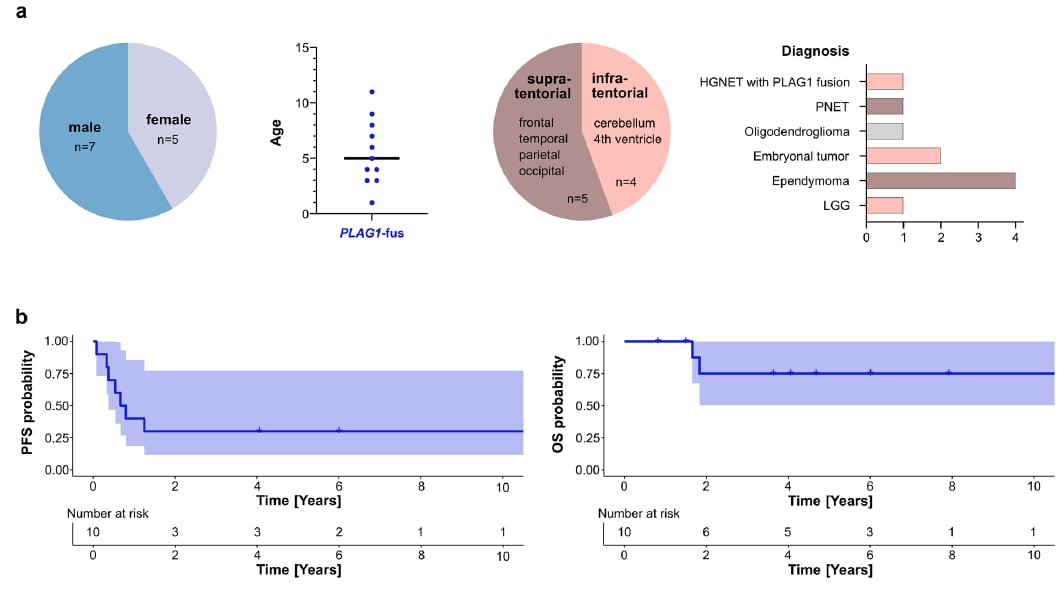 PLAG1融合:中枢神经系统胚胎性肿瘤分子分型新突破,揭示潜在靶点 11 图片
