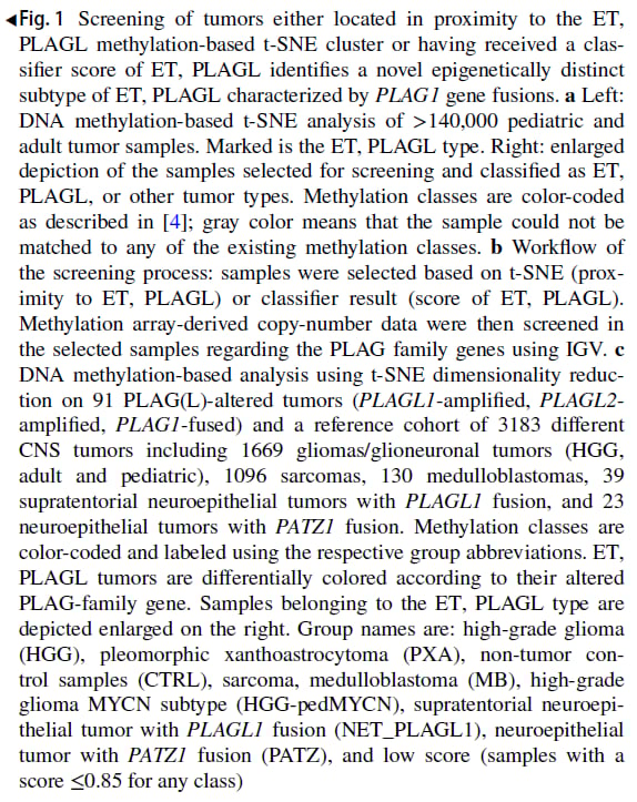 PLAG1融合:中枢神经系统胚胎性肿瘤分子分型新突破,揭示潜在靶点 5 图片