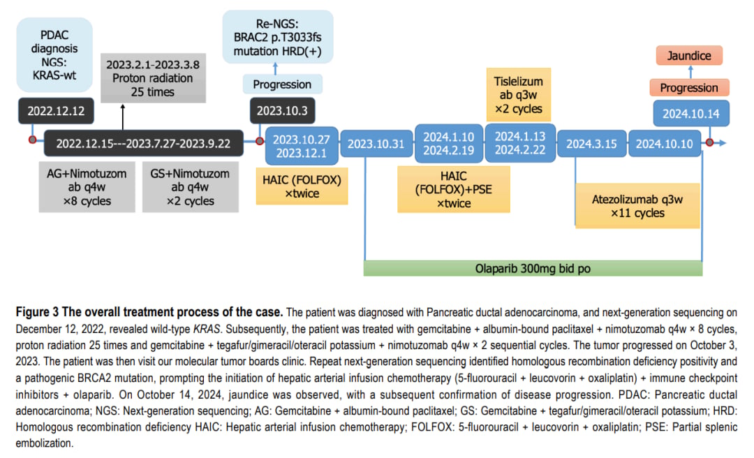 晚期胰腺癌肝转移患者的精准治疗:BRCA2突变与奥拉帕利联合方案的突破 3 图片