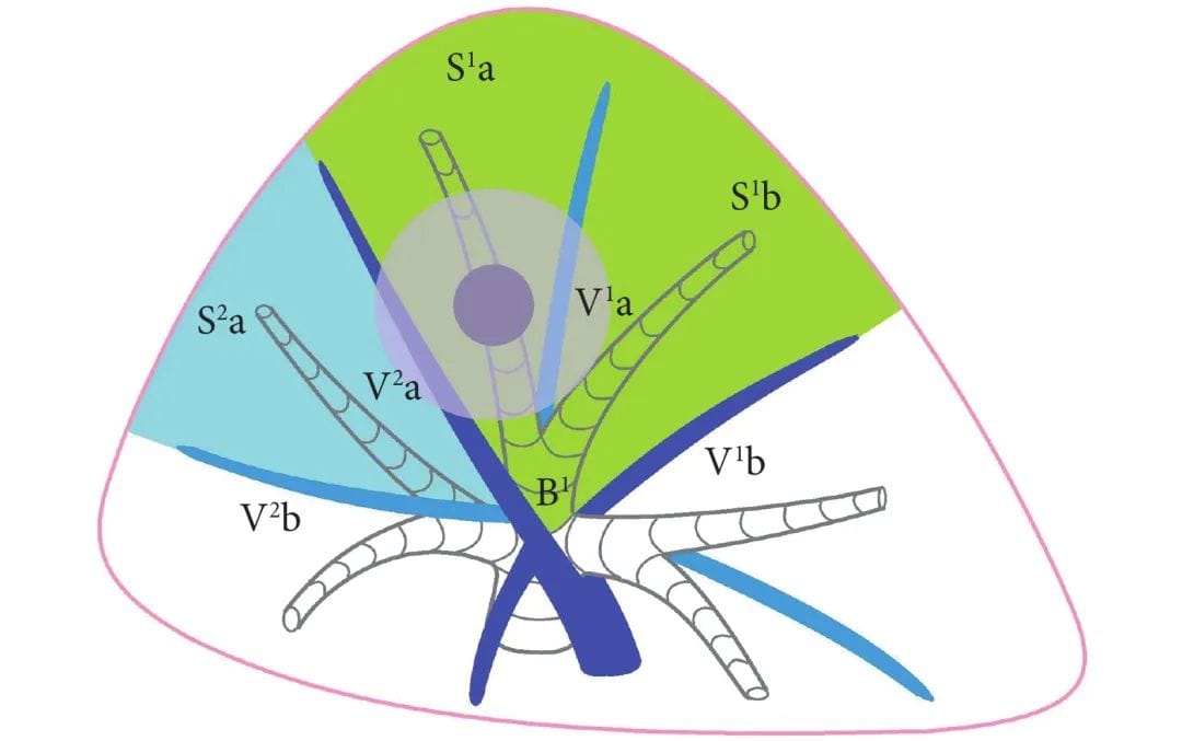 早期肺癌手术新突破:3D肺段切除术疗效媲美传统肺叶切除 2 图片