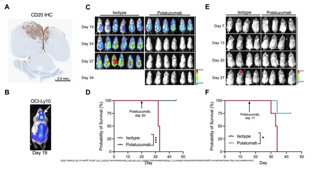 维泊妥珠单抗突破血脑屏障,为中枢神经系统淋巴瘤治疗带来新希望 2 2.jpg