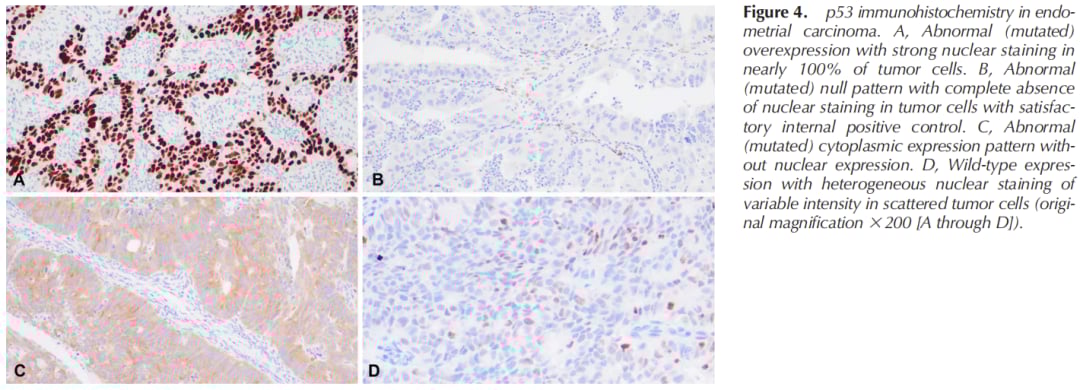 2024妇科肿瘤精准治疗指南:读懂HER2/PD-L1检测,选对靶向药 3 图片