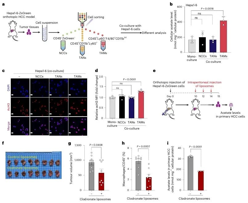 肝癌转移新突破:《Nature》子刊揭示肿瘤“帮凶”如何助长癌细胞扩散 2 图片