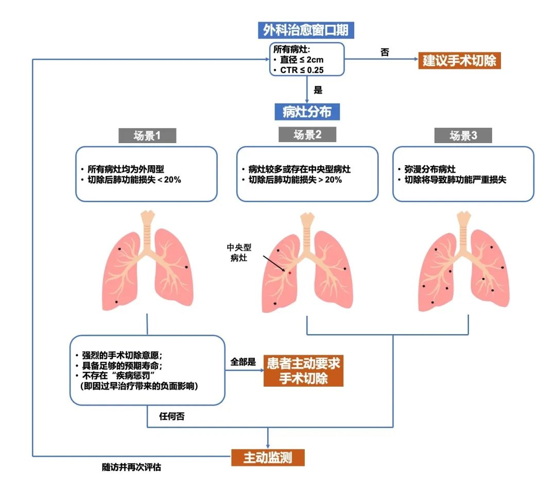 肺部磨玻璃结节一定要手术吗?最新研究证实:主动监测下5年生存率100%! 3 b245859a007a43c280ee2c6a4fb732ae-Sq2ULMi