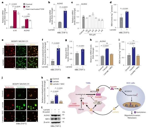 肝癌转移新突破:《Nature》子刊揭示肿瘤“帮凶”如何助长癌细胞扩散 6 图片