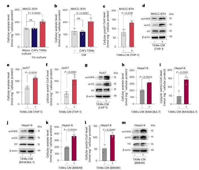 肝癌转移新突破:《Nature》子刊揭示肿瘤“帮凶”如何助长癌细胞扩散 3 图片