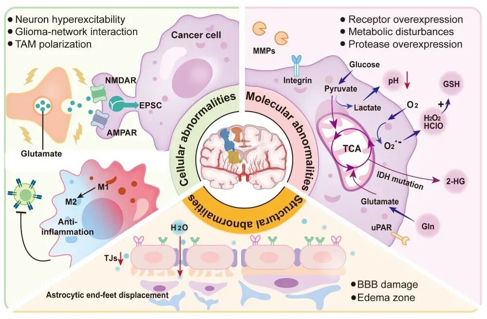 脑胶质瘤手术难题:如何精准切除?新型影像探针或成破局关键 1 图片