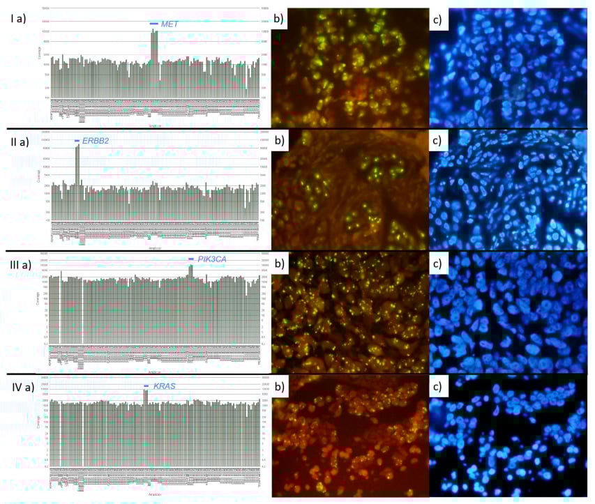 非小细胞肺癌精准治疗新选择:NGS检测MET/ERBB2基因扩增的可靠性获证实 1 图片