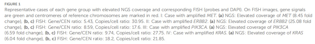 非小细胞肺癌精准治疗新选择:NGS检测MET/ERBB2基因扩增的可靠性获证实 2 图片