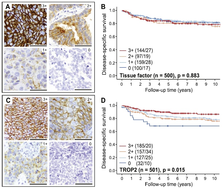 宫颈癌精准治疗新篇章:靶向与免疫疗法中的关键生物标志物检测与创新药物解析 16 图片