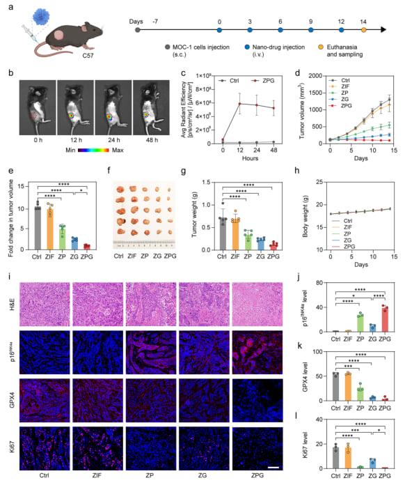 帕博西尼联用Ga³⁺纳米平台:口腔鳞癌等CDK4/6高活肿瘤治疗新突破,增强疗效与安全性 8 图片